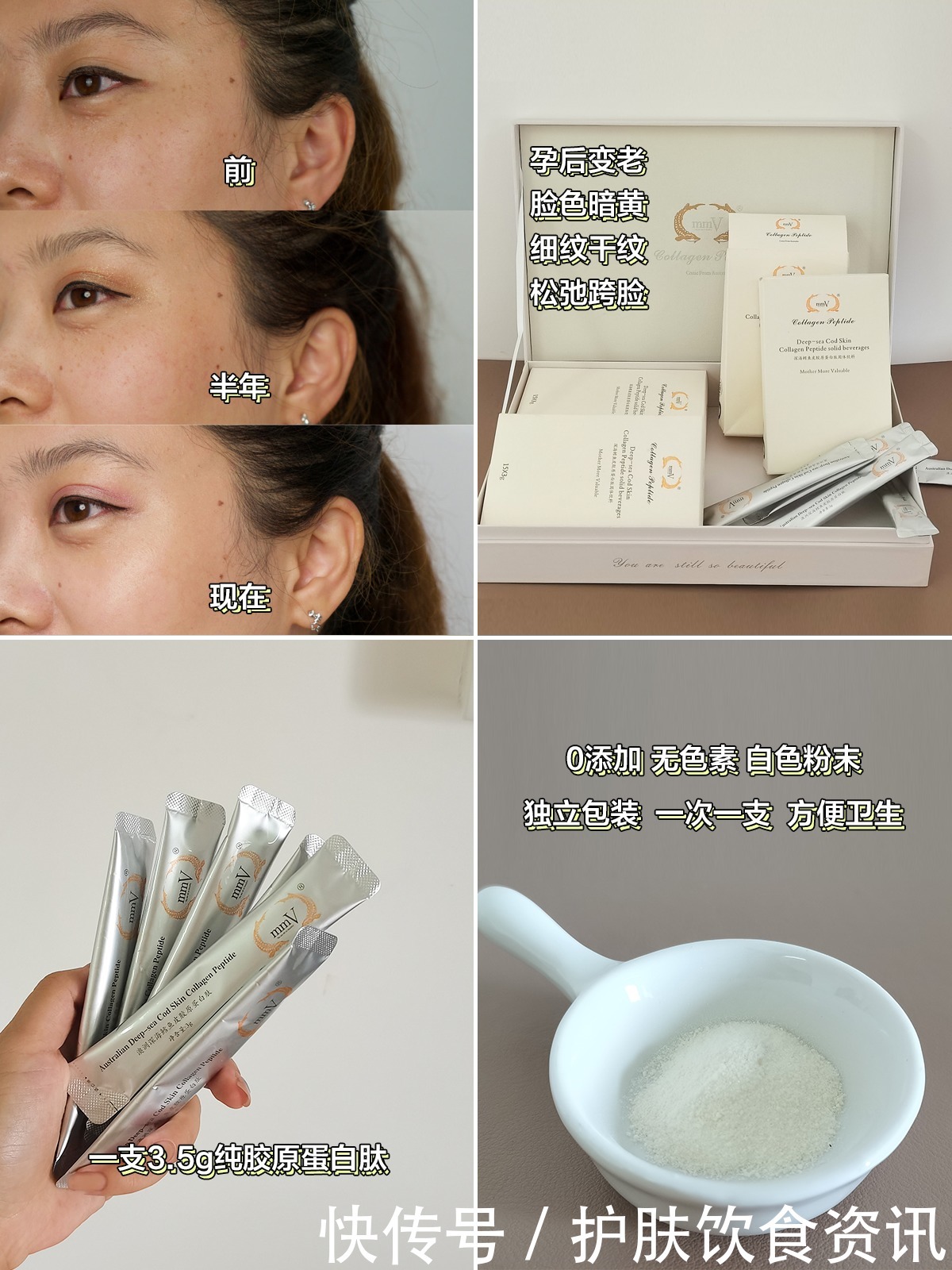 澳洲|《我是大美人》种草的澳洲mmV胶原蛋白肽—祛皱美白,消除细纹!效果堪比微整形!