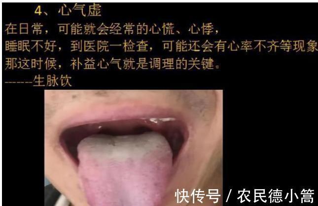 久病|气虚到底应该怎么补?中医师:分清这“4种”气虚,快速补气