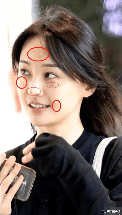 影响|爱挤痘痘的这些女星,现在皮肤都是什么样看这2个例子就知道了