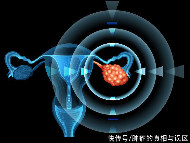 遗传|癌症会一代传一代？父母若得了5种癌，子女可能会“继承”