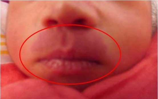 事孕妈|怀孕后三件事孕妈最好别做,容易在宝宝身上留下“胎记”!