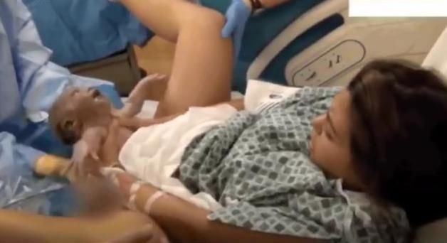 彪悍|外国宝妈直播生娃,直接用手拽出来医生彪悍的人生不需要解释