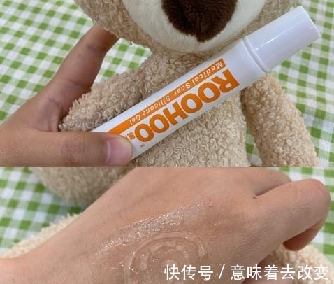 unny|你真的是敏感肌吗?敏感肌该怎么护肤???