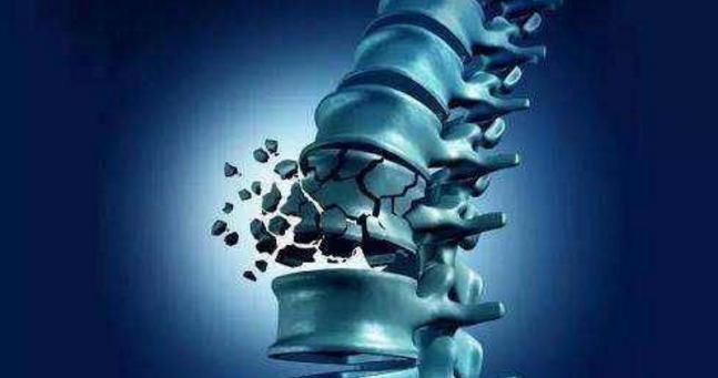 骨质疏松|卵巢早衰的女人,身上一般会显现4种“异常”,希望提高警惕