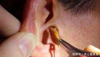 耳朵|7岁男童总说耳朵痒,妈妈用手电筒一看,身上的鸡皮疙瘩都起来了