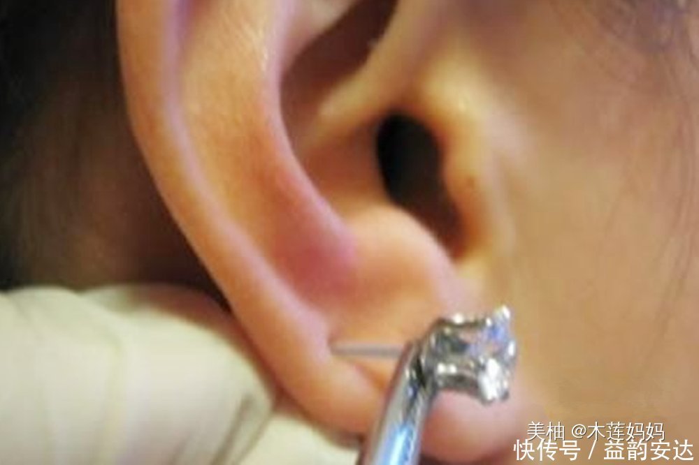 耳钉|为什么不建议家长给孩子打耳洞?专业医生表示:要去正规的医院