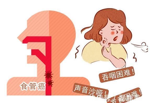 症状|医生坦言身体若有“三感一痛”的表现,或是早期食管癌的症状
