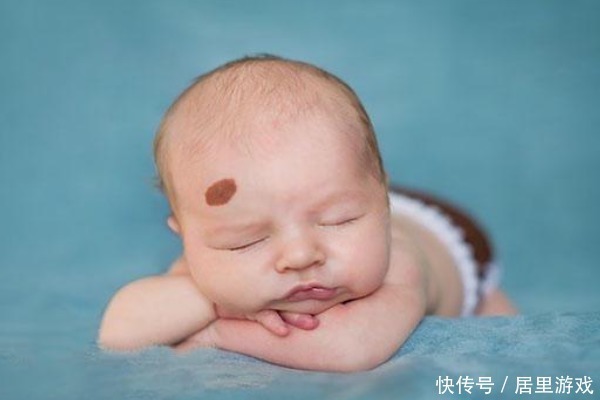 宝宝|宝宝为什么会长胎记？与孕期行为有关，孕妈怀孕后要克制自己