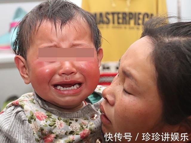 皮皮|孩子积食,身体会发出五个信号,中招的父母快停手,别再喂娃多吃