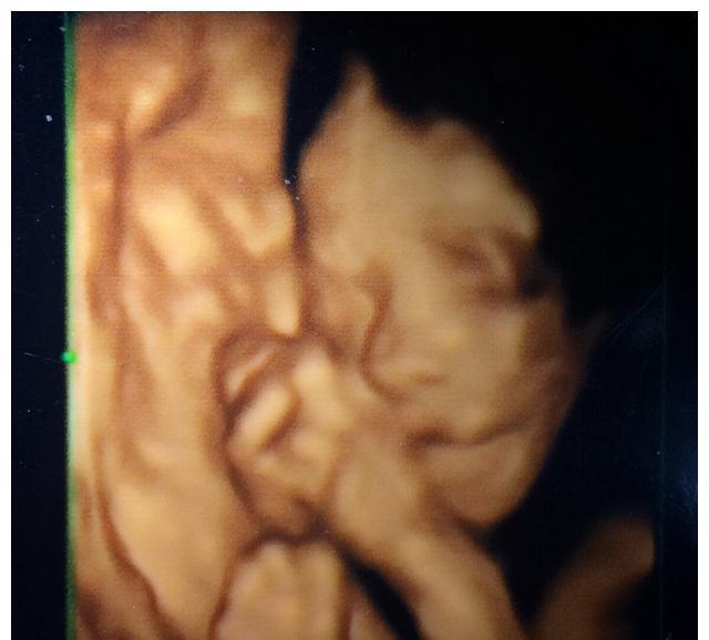 宝妈|怀孕产检可以不用全程陪,但这三个产检项目,宝爸们请别缺席