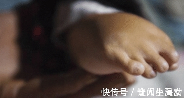 残疾|男婴先天性残疾,手脚长倒了,父亲却一走了之,把老人坑惨了!