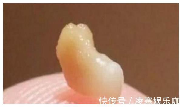 口腔|孩子因口气臭被同学排挤,送诊查检后,医生都没忍住恶心呕吐