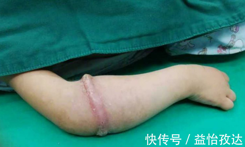 铆钉|三岁女孩一直说手臂疼，送到医院检查后，医生说你们差点后悔一生