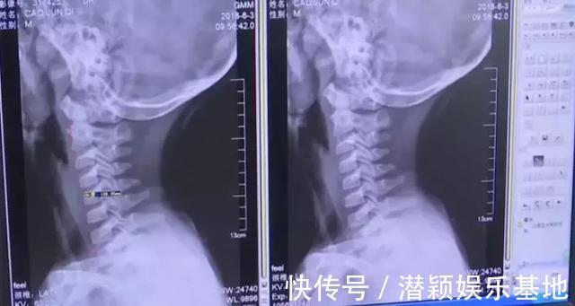 手机|一年来男孩一直做一件事,妈妈发现后立刻送医,医生却说:来晚了