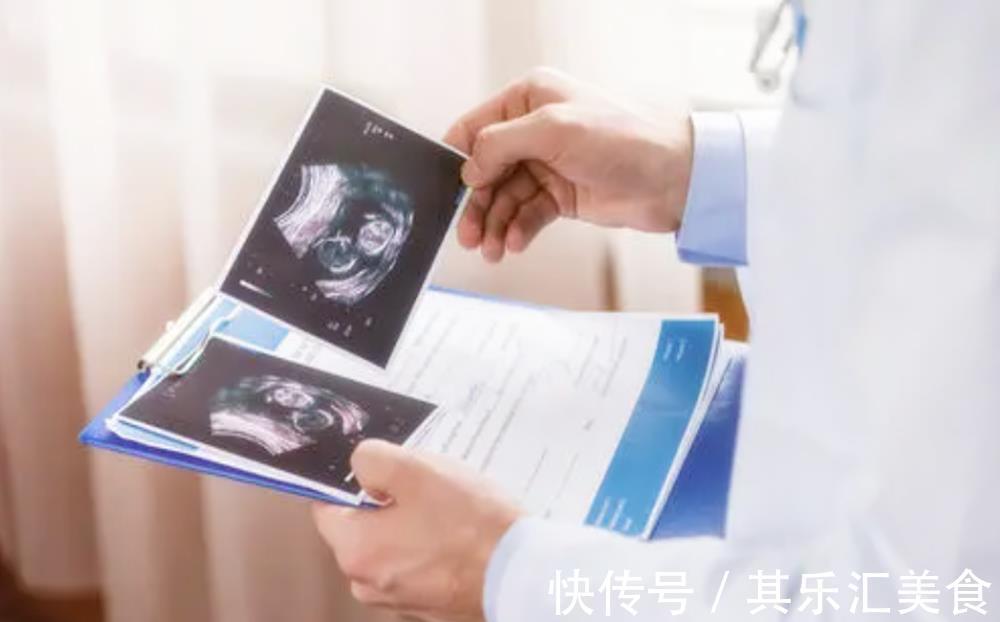 宝宝|四维彩超背后隐藏的几个“误区”,孕妈别再傻傻相信了,真没必要