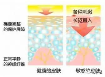 锐敏老师推荐：痘痘不及时护理？小心秒变痘痘肌！