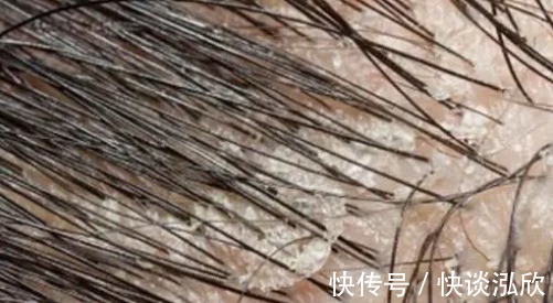 氨基酸|孕妈谨慎!被医生拉入黑名单的洗发水!孕妈该选宝藏级洗护看这里