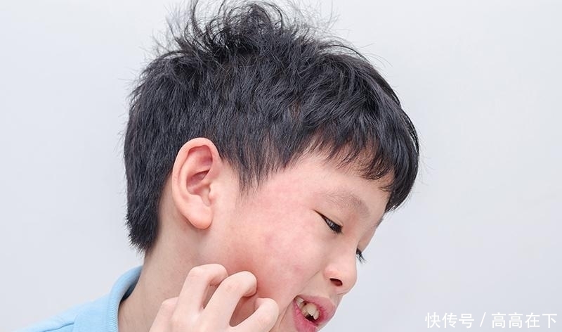 你也是肌肤敏感族？3不做避免成为长期发炎肌！