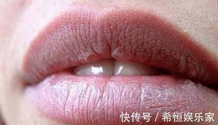 呼吸困难|血液稠不稠看嘴巴!若没出现3个信号,恭喜血管还很畅通!