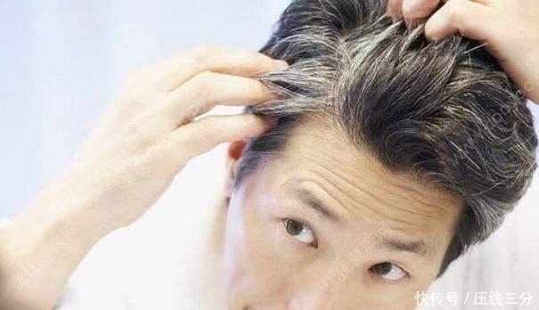 白头发长在这里很危险，不妨看看，让身边的人提高警惕