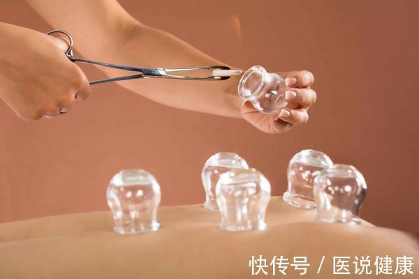 火罐|拔火罐时,要注意这4件事,否则反而会导致健康受损,需了解