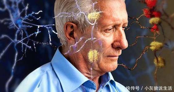 尽早|老年痴呆的“祸根”被爆出,多数老人不离口,子女要尽早劝阻