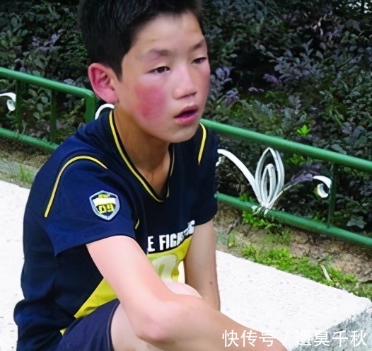 《变形记》16岁巨婴:每天花销过万、吃饭要人喂,今成了这样