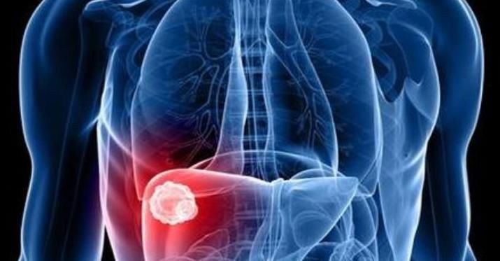 枸杞|泡枸杞时加此物，肝毒没了，远离肝硬化、肝癌，肝会跪谢你的做法