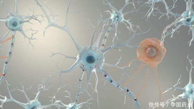 超准老年痴呆测试如果2分钟内你可以做完,恭喜你大脑很聪明