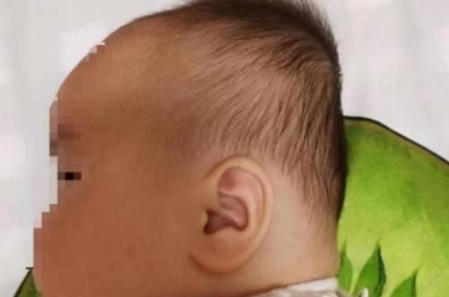 发育|“睡头型”和“不睡头型”的宝宝,长大后有何区别?对比很明显