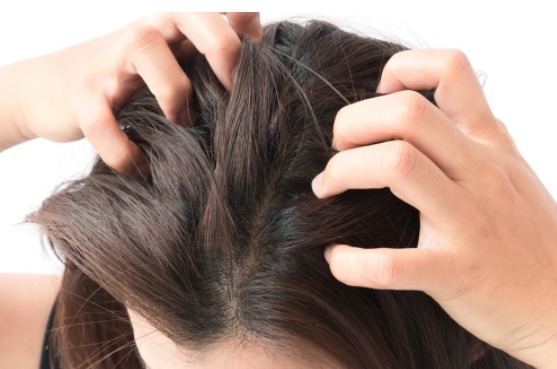 中医|中医古方两味药睡前洒在头发上,第二天头发不油了头屑全没了