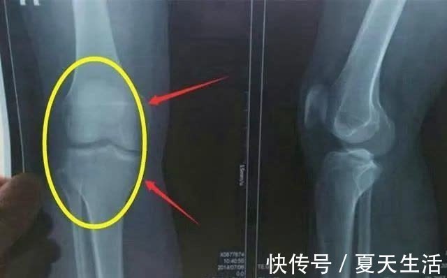 心理健康|影响孩子长高的因素，除了睡眠之外，这些因素也很关键，父母自查