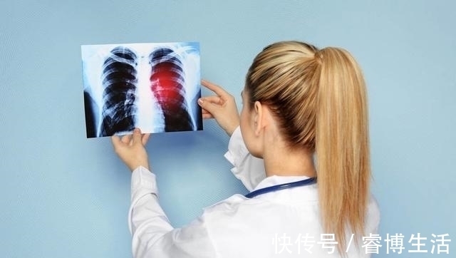 早期|肺癌早期症状是什么样的肿瘤科医生把最关键的内容说出来了