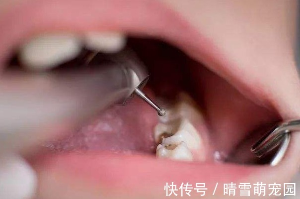 实验室|孩子退掉的乳牙,父母不要乱扔,关键时刻能救孩子一命!