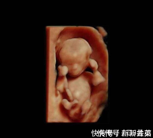 羊水|胎儿从卵泡到性别形成,17张图片清晰诠释,男宝女宝看得很清楚