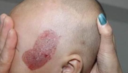 脑细胞|女性怀孕后,几件事孕妇最好不要干,要不然出生的婴儿可能有胎记