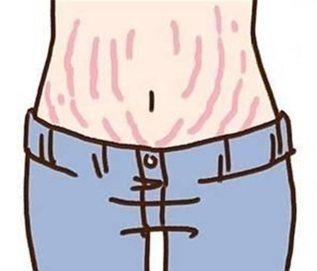 孕妇|妊娠纹是怎么产生的?网友用塑料袋像大家展示,简直不要太形象