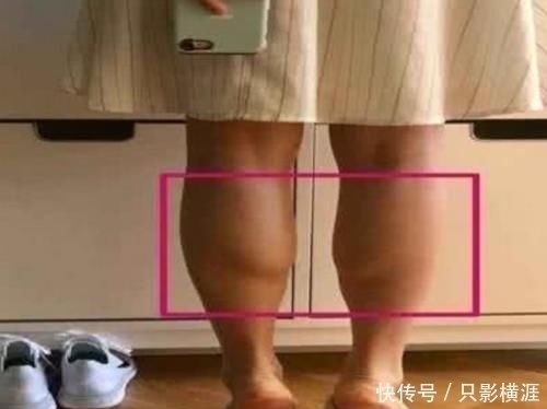 女生|为何有些女生明明很瘦却“腿粗”教你3招,“竹竿腿”自然来