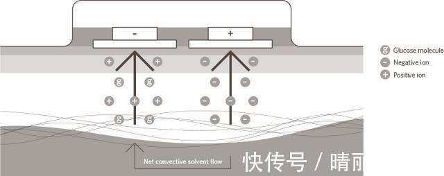 血糖水平|还在埋头扎手指？7款血糖监测新仪器拯救糖尿病患者