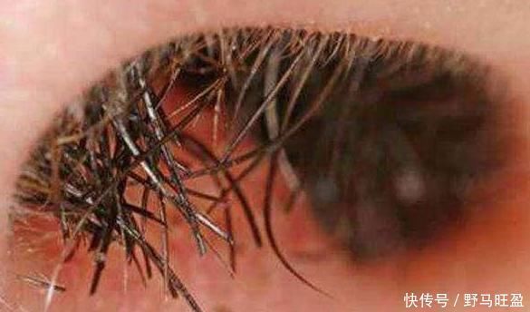 衰老|鼻毛为何会变白?八成与此3个原因有关,大多数人还不清楚