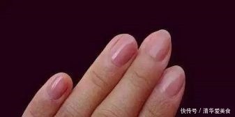 内分泌失调|没有妇科疾病的女人,手上有4个特征,你若占1个,子宫很健康