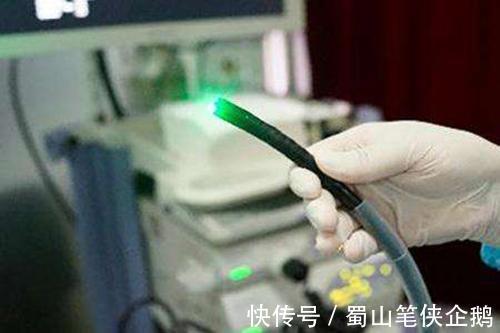 胃镜检查|做胃镜选无痛胃镜好 还是普通胃镜好?