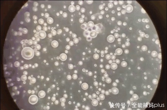 母乳|母乳是“活”的?在1000倍显微镜下长这样,纯净到令人不敢相信
