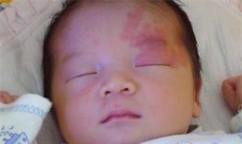 身体|孕妇最忌讳的就是做这样的事情,小心宝宝出生后满身胎记