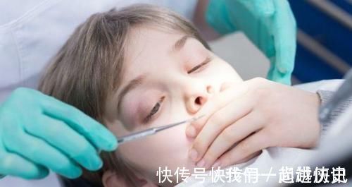 牙齿|不想孩子一口烂牙,这些坑可要避开了,家长多上心