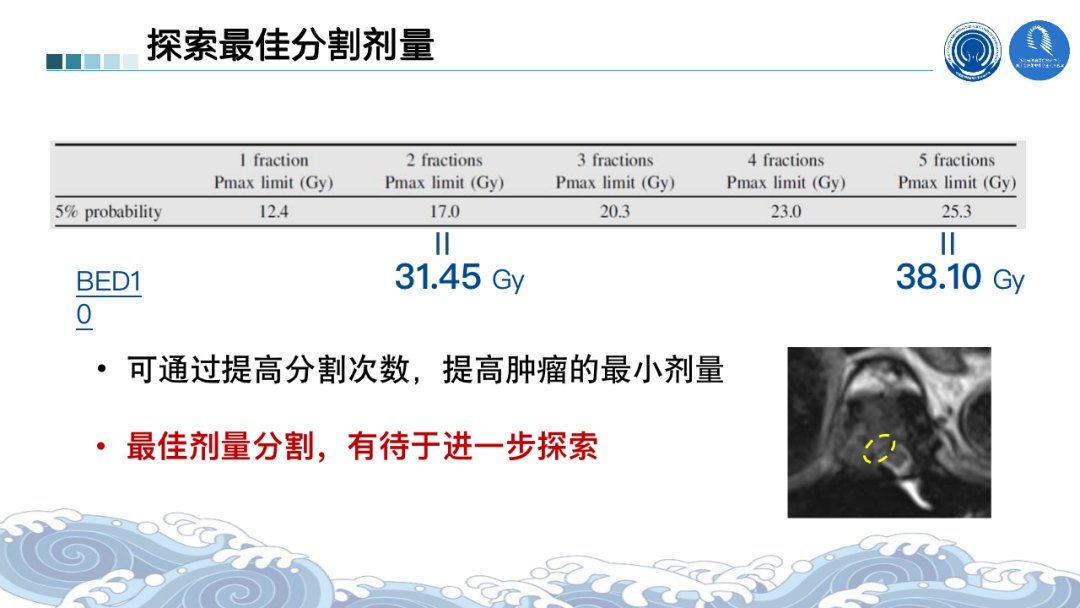 根治性|2021ASTRO丨骨脑转移瘤最新进展汇总