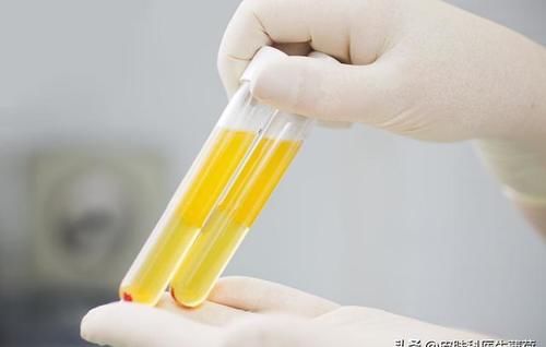 把血抽出来再打到脸上？这是什么丧心病狂的美容方法