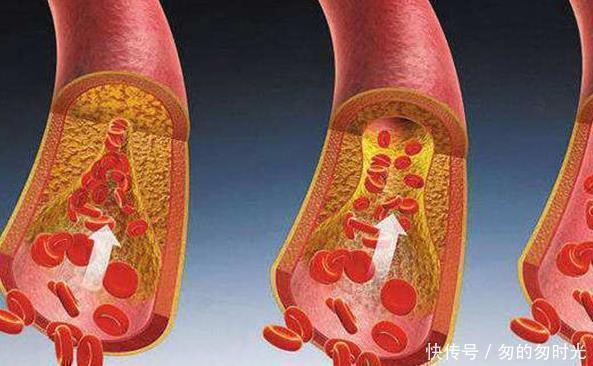 毛发|男性雄性激素旺盛，身上多半有3特征，若你占2个，恭喜男人味十足