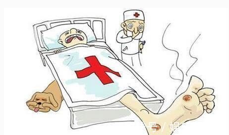 双脚|双脚若出现4个感觉,或是糖尿病足,还请及时就诊检查!