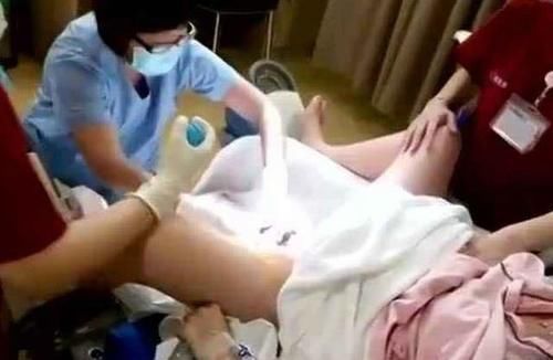 孕妇|分娩最尴尬的是啥这3件事所有孕妇都会遇到,医生这都不是事